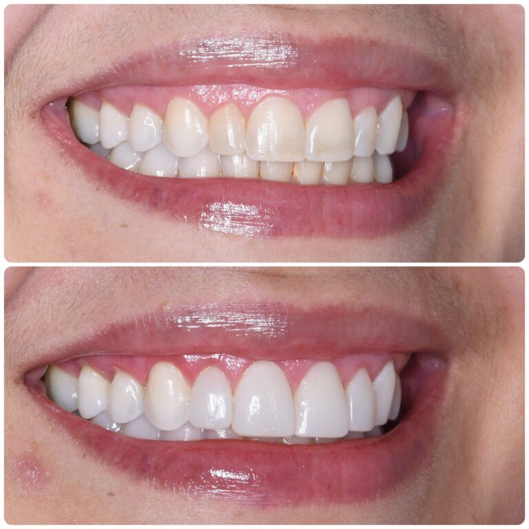 smile_makeover_2