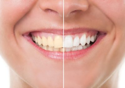 AestheticandRestorativeDentistry